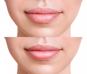 Sensual female lips before and after moistening.