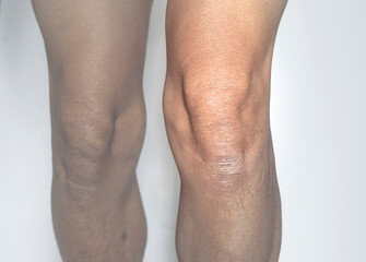 Fototapeta na wymiar Elderly knee leg muscles isolated on white