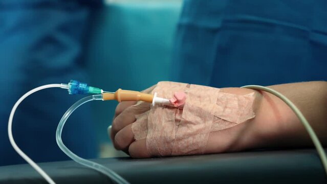 Surgeons in the operating room perform an operation on a patient. A complex surgical operation. Patient's hand close-up
