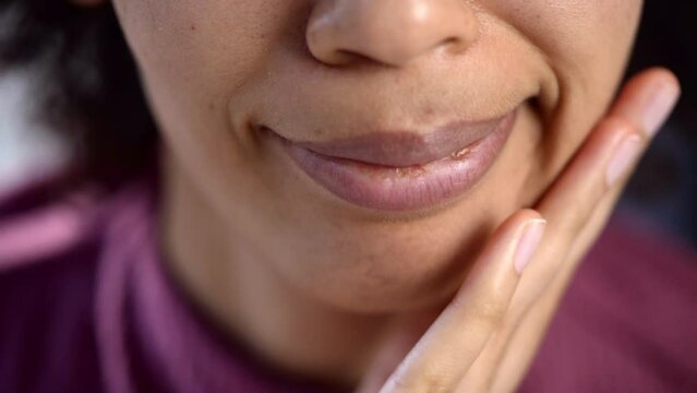 Sore Tooth And Decay. Woman Dental Health
