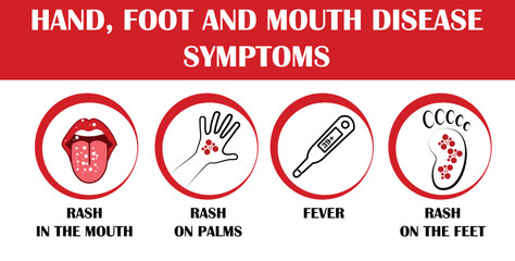 HFMD children infected. hand foot and mouth disease.