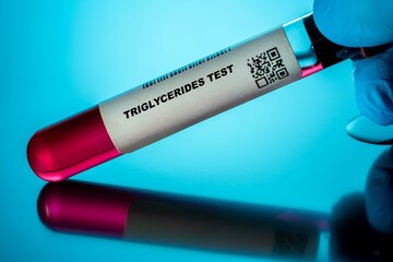 Triglycerides Test Blood Tests for Older Adults. Recommended Blood Test for the Elderly