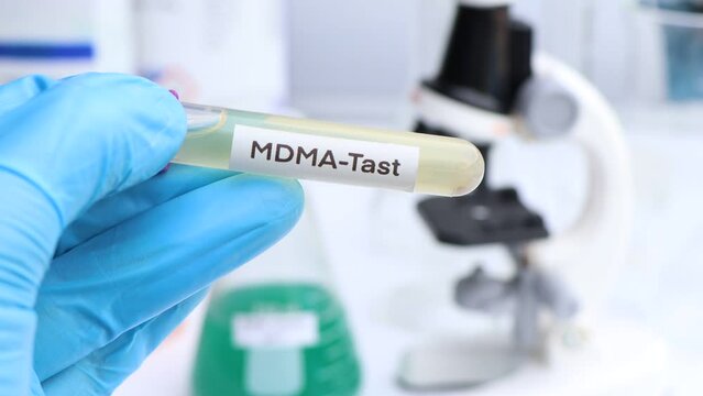 Urine samples for testing MDMA in the laboratory, urine sample in test tube