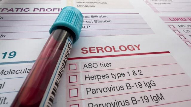 Medical request with test and Blood tube for analysis in the Serology laboratory. Medical health report with Test list for Serology analysis and blood sample tube of patient
