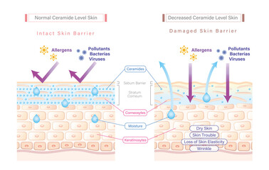 Ceramide in skin and skin barrier illustration comparing between sufficient ceramide skin and low ceramide skin. Why skin needs ceramides.