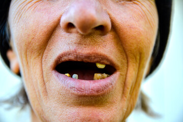 Woman with dental problems .