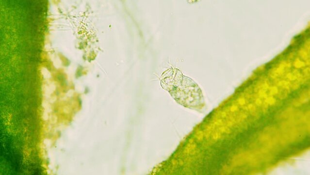 Vorticella attached to green algae branch. Making water flow with cilias and contracting body in case of danger. Seen in optical miscoscope 40x objective