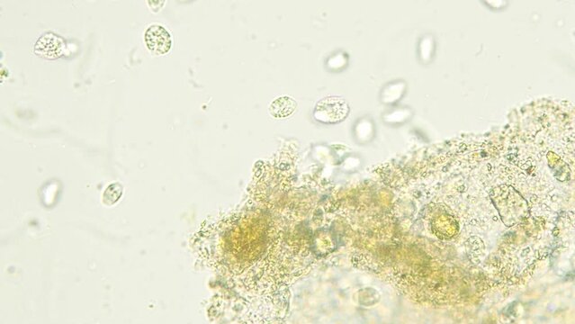 Colony of paramecium ciliates move fast in the water seen under optical microscope. 10x objective