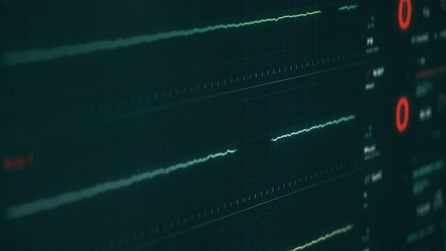Monitoring system shows the graph of the vital life signs. Monitoring equipment displaying the flat line graph of the vital health markers. Monitoring device shows the failure of vital organs. Graph.