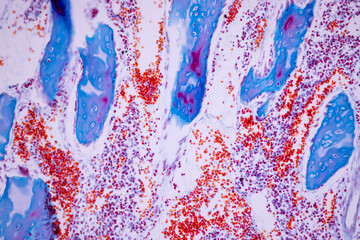 Hyaline cartilage, Elastic cartilage and Bone Human under the microscope in Lab.