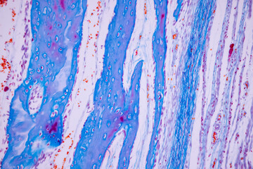 Hyaline cartilage, Elastic cartilage and Bone Human under the microscope in Lab.