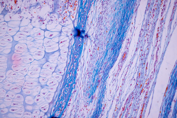 Hyaline cartilage, Elastic cartilage and Bone Human under the microscope in Lab.