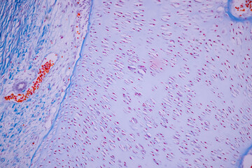 Hyaline cartilage, Elastic cartilage and Bone Human under the microscope in Lab.