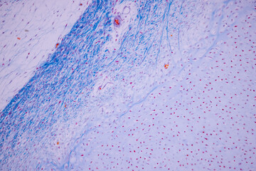 Hyaline cartilage, Elastic cartilage and Bone Human under the microscope in Lab.