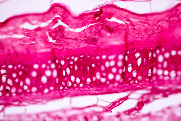 Hyaline cartilage, Elastic cartilage and Bone Human under the microscope in Lab.