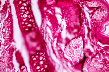 Hyaline cartilage, Elastic cartilage and Bone Human under the microscope in Lab.