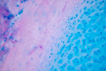 Hyaline cartilage, Elastic cartilage and Bone Human under the microscope in Lab.