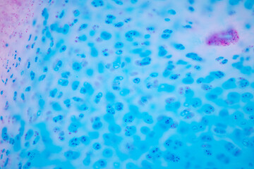 Hyaline cartilage, Elastic cartilage and Bone Human under the microscope in Lab.