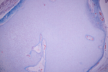 Hyaline cartilage, Elastic cartilage and Bone Human under the microscope in Lab.