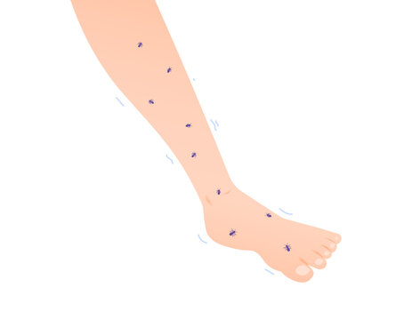 Feet Felt Like Being Swarmed By Ants. Symptoms Of Tingling, Tremor, Leg Paralysis And Numbness. Legs Shaking And Sore. Health Problem. Character Illustration Design