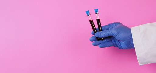 Doctor hands holding two blood test tubes on pink background. hand wear purple latex glove.