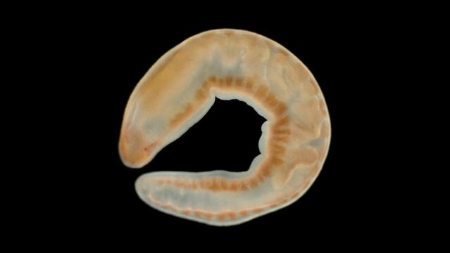 Worm Arctostemma arcticum under the microscope, phylum Nemertea, order Monostilifera. The specimen was found in the White Sea.