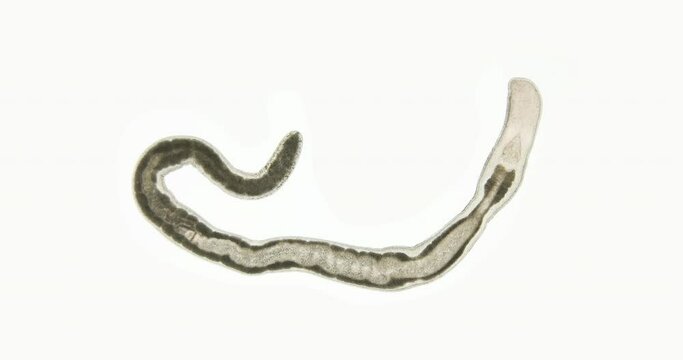 Nemertea worm under a microscope, class Hoplonemertea, order Monostilifera. The specimen was found in the White Sea.