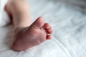Newborn foot. Little fingers, peeling skin. White background