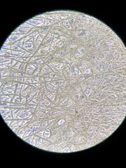 fungus mycelium under the microscope