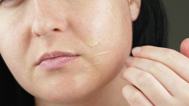A woman with dilated skin applies a serum, cream to the skin. Care for the pale skin of the face.