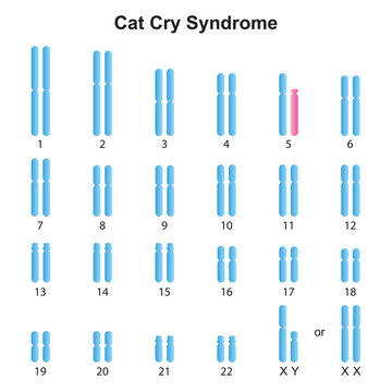 Scientific Designing Of Cat Cry Syndrome Karyotype. Colorful Symbols. Vector Illustration.