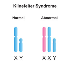 Scientific Designing of Klinefelter Syndrome (XXY). Colorful Symbols. Vector Illustration.