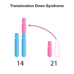 Scientific Designing of Robertsonian Translocation Down Syndrome. Colorful Symbols. Vector Illustration.