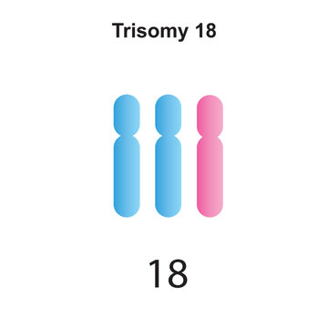 Scientific Designing of Edwards Syndrome (Trisomy 18). Colorful Symbols. Vector Illustration.