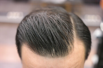 Close-up of neatly trimmed man's head