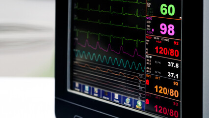 Patient monitor displays vital signs ECG electrocardiogram EKG, body temperature, oxygen saturation SPO2 and respiration.                            