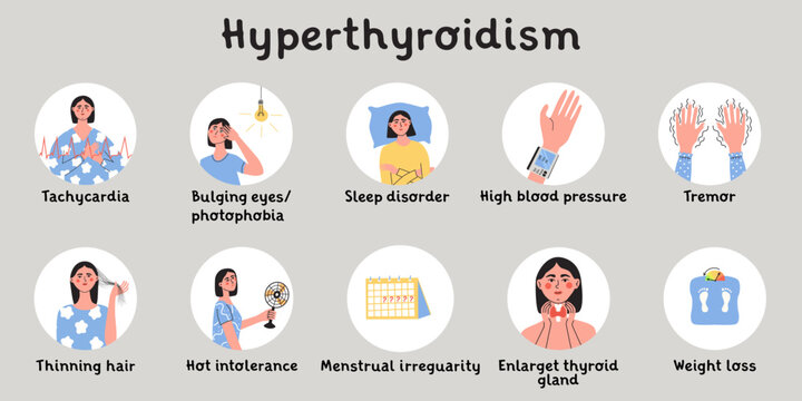 Hyperthyroidism symptoms. Thyroid gland problem with endocrinology system, hormone production. Infografic with woman character. Flat vector medical illustration