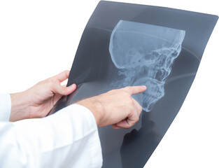 Portrait doctor man holding and looking x-ray film transparent file.