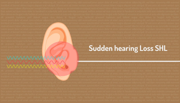Poster about sudden hearing loss