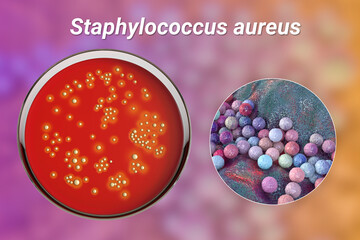 Bacteria Staphylococcus aureus, 3D illustration