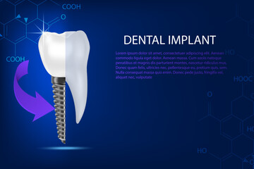 Tooth conditions healthy, dental implant on an abstract blue technology background.