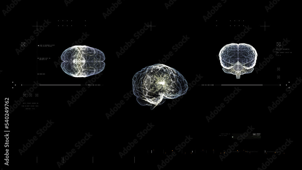 Aufkleber advance biomedical neuron pathology and diagnostic scan