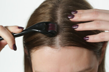 Woman using microneedle derma roller on head for stimulating new hair growth. Simple and cheap...