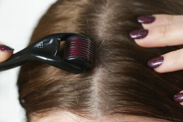 Woman using microneedle derma roller on head for stimulating new hair growth. Simple and cheap treatment for the healthy scalp.
