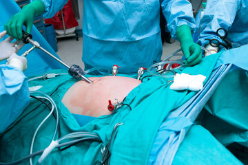 Group of surgeons doing surgery in hospital operating theater operating room