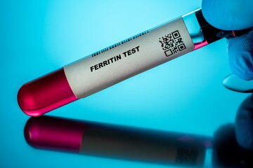 Ferritin Test Blood Tests for Older Adults. Recommended Blood Test for the Elderly