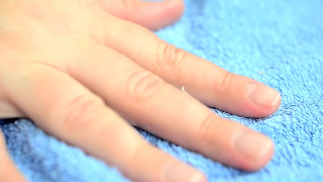 Female hand. We delete agnails