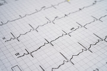 Electrocardiogram  ECG with red heart, heart wave, heart attack, cardiogram report.