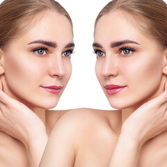 Female lips before anf after augmentation procedure.