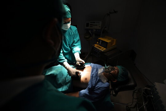 Closeup image of professional concentrated surgical team performing CPR with defibrillator on patient in hospital operating room or emergency room. Surgery concept